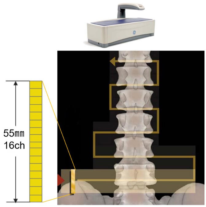 Technical Tips_detector array06.jpg
